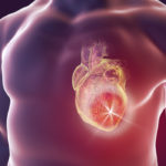 After Heart Attacks-Rheumatoid Arthritis Drug May Help Repair Heart