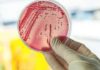 New way to test for drug resistant infections New way to test for drug resistant infections