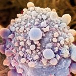 Pancreatic Cancers can be caused by Fungal Invasion : Finds Study Pancreatic Cancers can be caused by Fungal Invasion : Finds Study