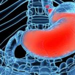 Adverse Reactions increased in children due to use of common Reflux Aids_ Finds study Adverse Reactions increased in children due to use of common Reflux Aids_ Finds study