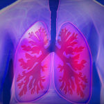 Newly Discovered Three-drug combination to improve lung function in CF patients