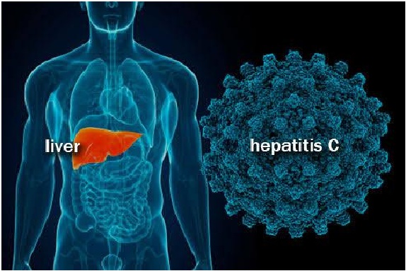 Is Hepatitis C Curable Is Hepatitis C Curable