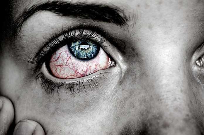 eye-743409_1920 Red Eyes