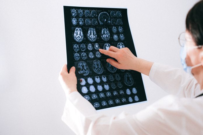 What Are the Common Causes of Neurobehavioral Disorders? What Are the Common Causes of Neurobehavioral Disorders?