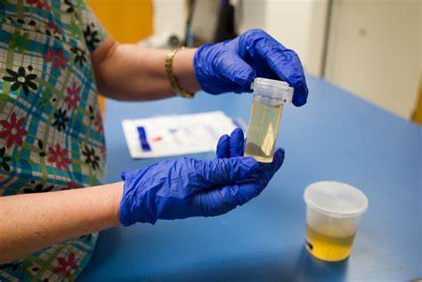 Does HHC Fail A Drug Test? Does HHC Fail A Drug Test?