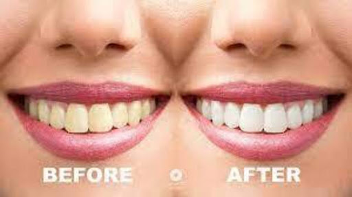 How to whiten teeth in photoshop