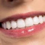 how to whiten teeth in photoshop